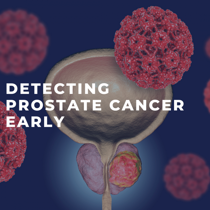 Detecting Prostate Cancer Early
